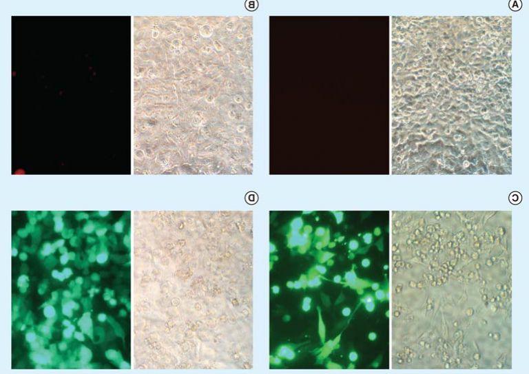 Figure 4. 用4 μl TransfeX与表达腺病毒的1 μg质粒DNA (Monster Green®荧光蛋白)或绿色荧光蛋白复合物在48孔板上转染HeLa细胞后，荧光显微镜观察转染效率. (A)未经处理的对照细胞. (B) DNA-treated cells. (C)转染TransfeX的细胞. (D)腺病毒转导细胞. Left panels: Phase contrast images; Right panels: Fluorescence images.