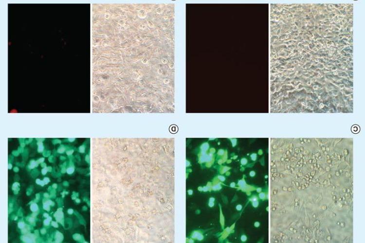 Figure 4. 用4 μl TransfeX与表达腺病毒的1 μg质粒DNA (Monster Green®荧光蛋白)或绿色荧光蛋白复合物在48孔板上转染HeLa细胞后，荧光显微镜观察转染效率. (A)未经处理的对照细胞. (B) DNA-treated cells. (C)转染TransfeX的细胞. (D)腺病毒转导细胞. Left panels: Phase contrast images; Right panels: Fluorescence images.